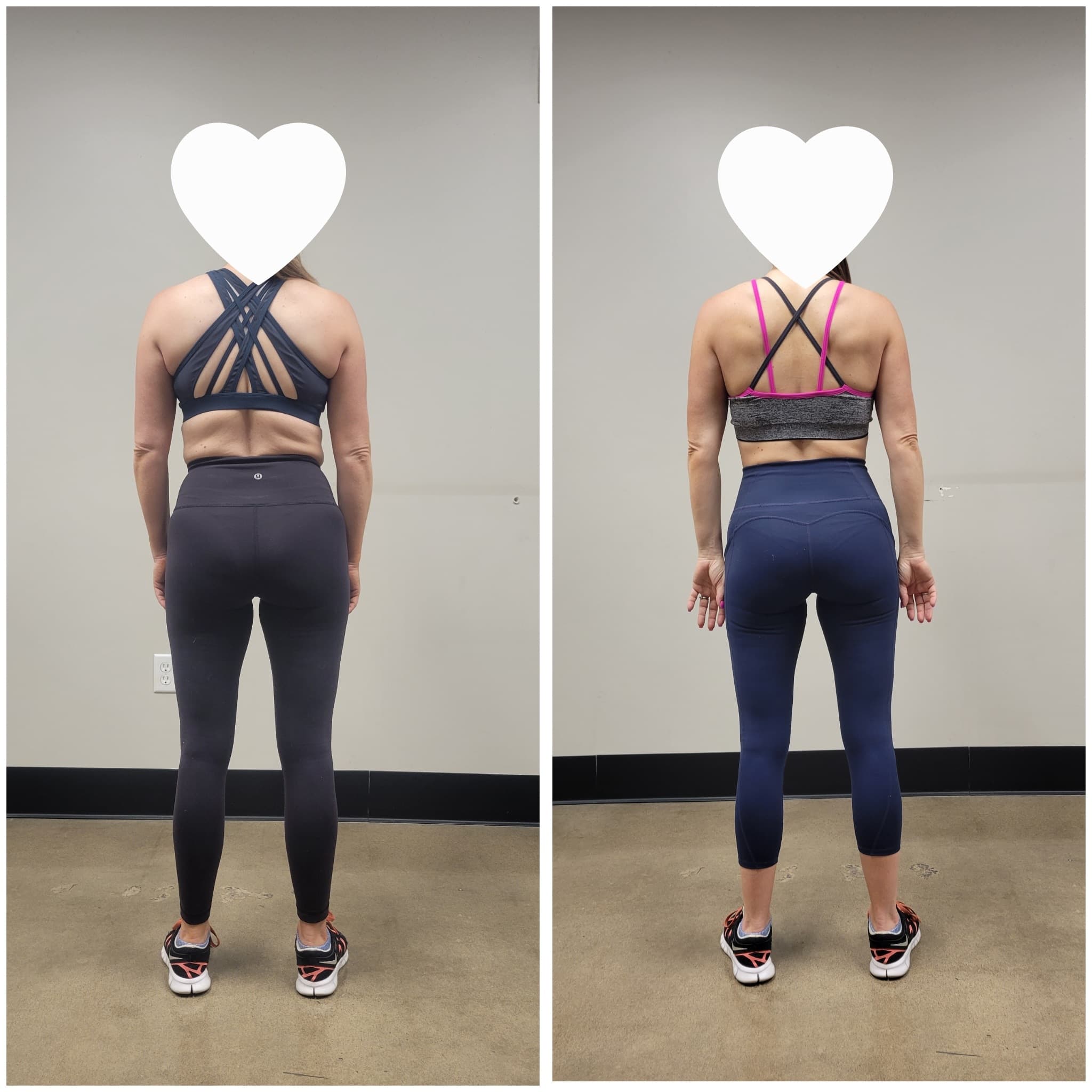 Woman's back before and after, revealing a more toned physique and less back fat.